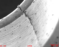 Images of Fractures from failure analysis.